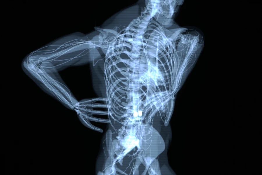 Why back pain is frequently misattributed to the spine back pain natalia skizha Why back pain is frequently misattributed to the spine back pain natalia skizha